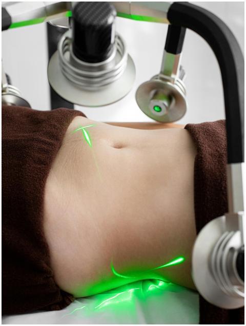Close-up of a woman's abdomen during a laser lipos