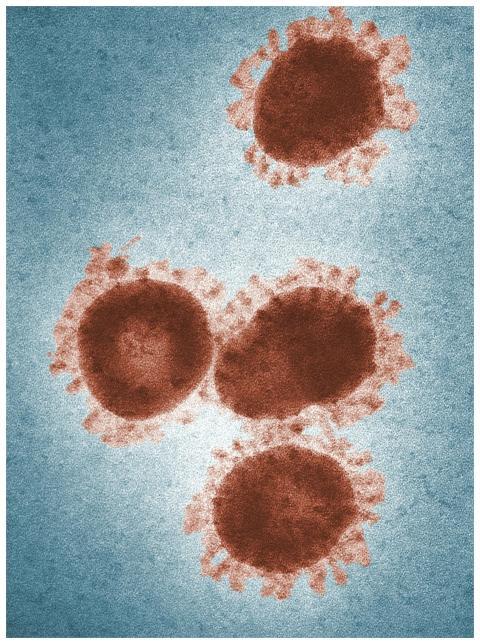 Colorized electron microscope image showing corona