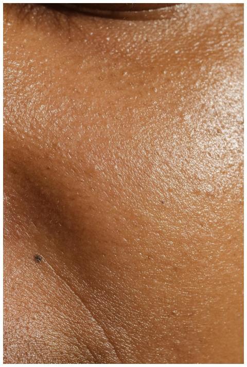 High-resolution close-up of human skin showing por