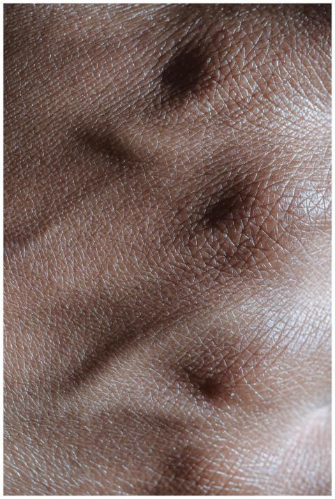 Detailed close-up of human skin texture, showcasin
