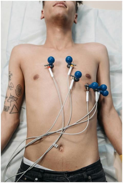 A young man lying down for an ECG procedure with e