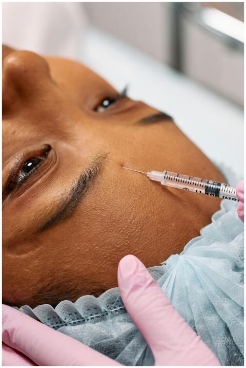 Close-up image of a cosmetic procedure showing a n