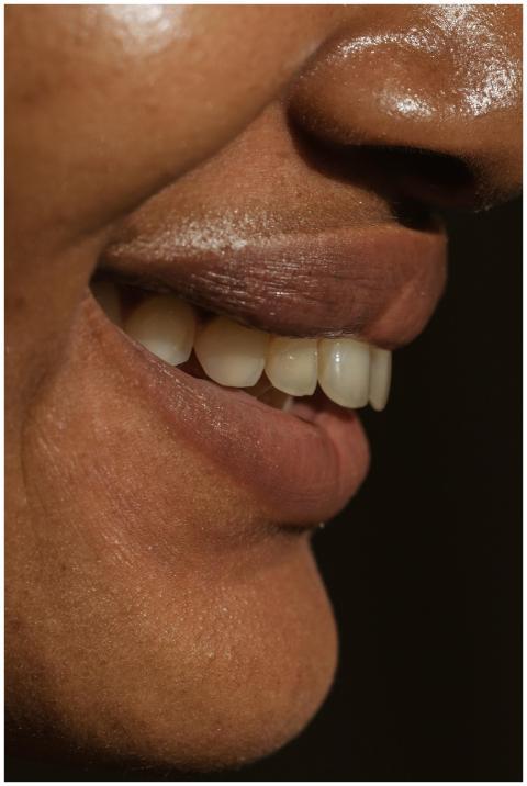 A detailed close-up of a smile showcasing natural