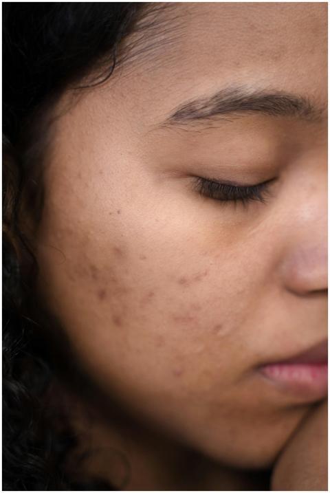 Extreme close-up of a woman's face showing skin im