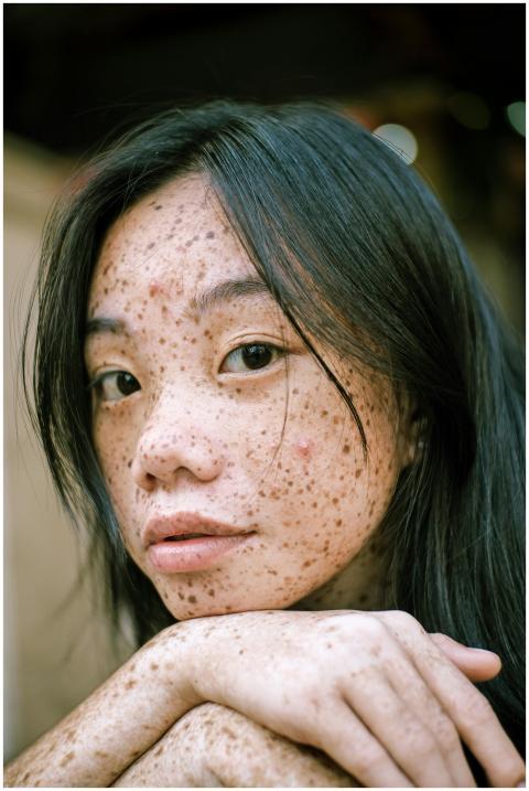 Intimate portrait highlighting the unique freckles