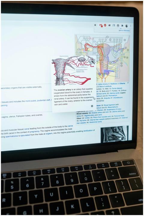 Close-up of a laptop screen illustrating anatomica