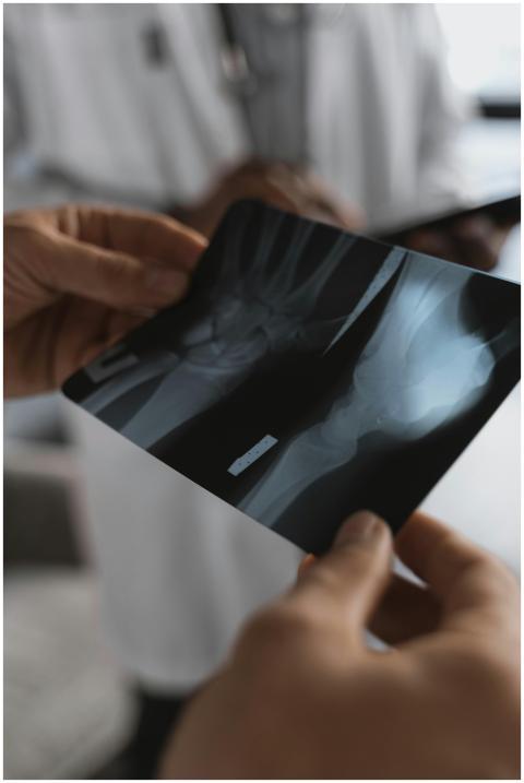 Close-up of hands holding an X-ray image in a medi