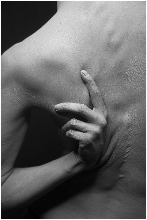 Detailed close-up of dry, flaky skin in a monochro