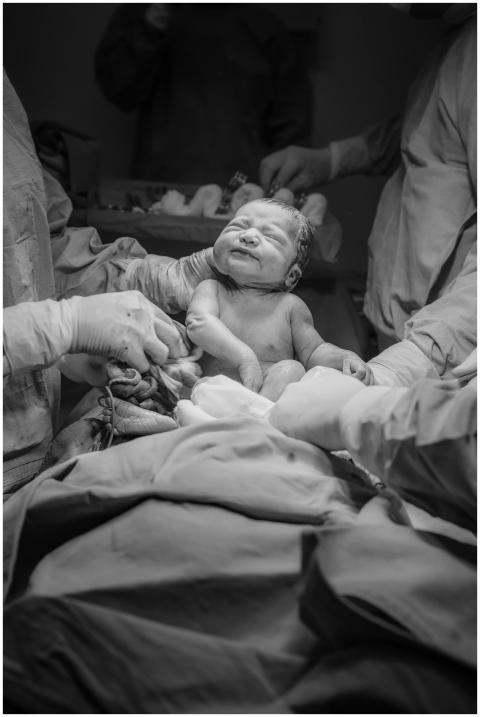 A newborn baby in a hospital delivery room, surrou