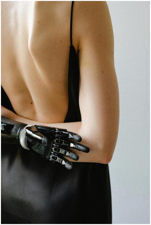 Stylish woman with a prosthetic arm in a black dre