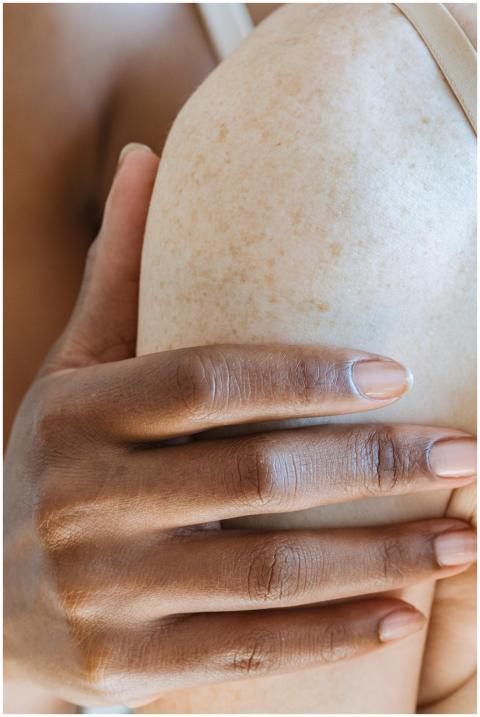 Close-up of diverse hands touching freckled skin,