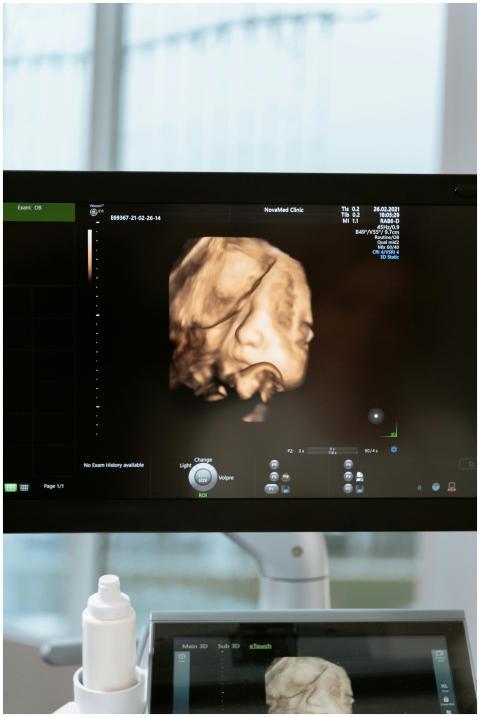 A detailed 3D ultrasound scan displaying a fetus o