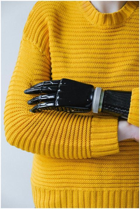 Close-up of a prosthetic arm crossed over a yellow