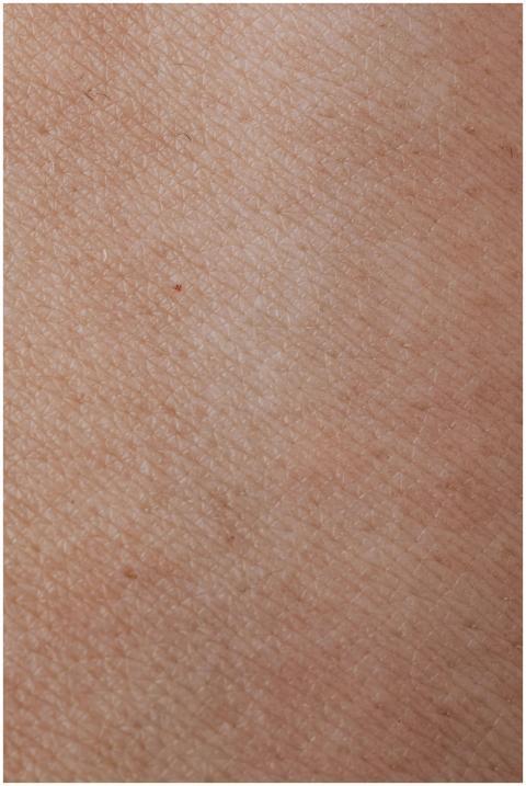 Detailed macro shot of human skin showing natural