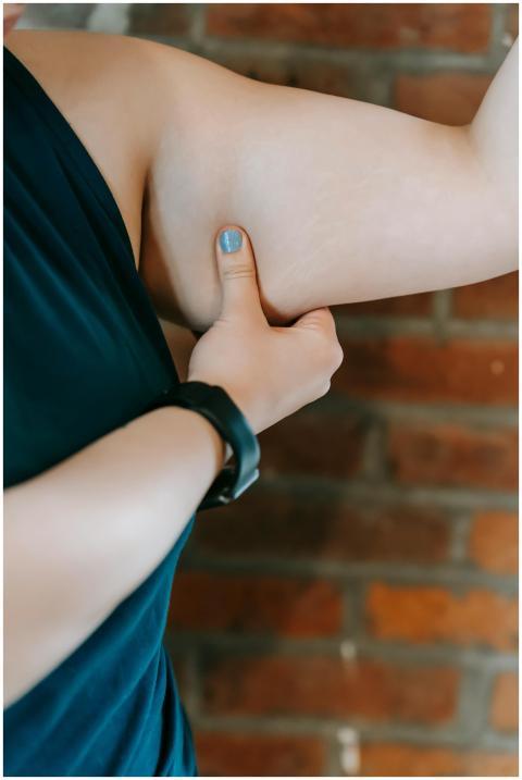 A woman pinches her tricep skin to evaluate body f