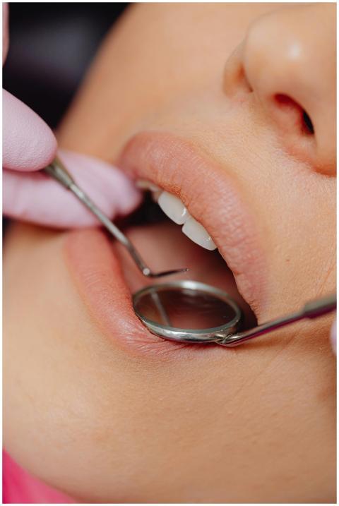 Close-up view of a patient's dental check-up using