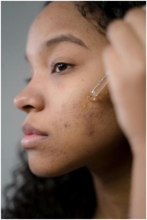 Close-up side view of a woman applying serum to he