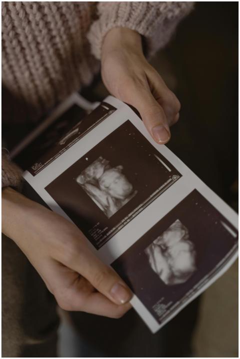 Hands gently holding ultrasound images, depicting