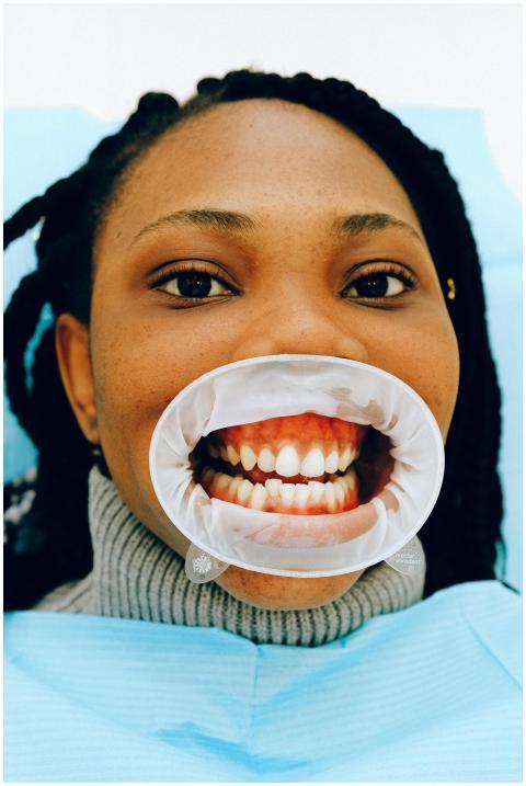Face of a woman during a dental exam with a mouth