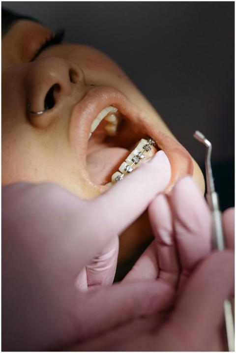 Dentist examining patient's braces during a dental