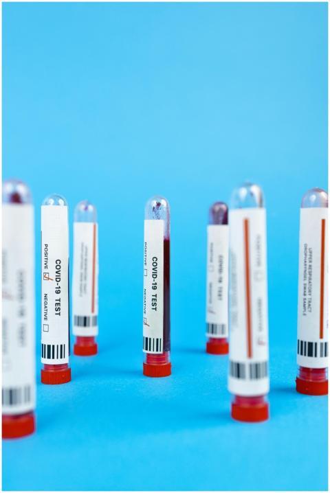 Close-up of COVID-19 blood test tubes on a blue ba