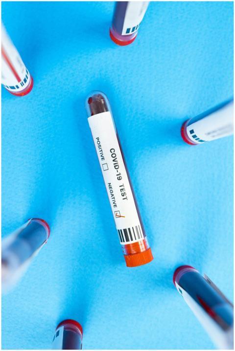 Top view of COVID-19 blood test vials arranged on