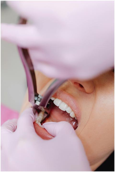 A dentist performs a tooth extraction on a patient