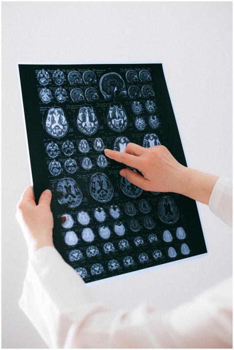 A medical professional examines a brain MRI scan,