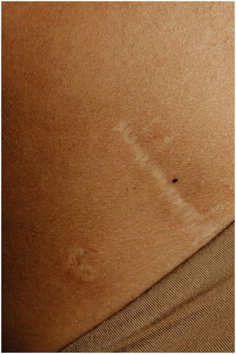 Detailed close-up shot of natural skin texture sho