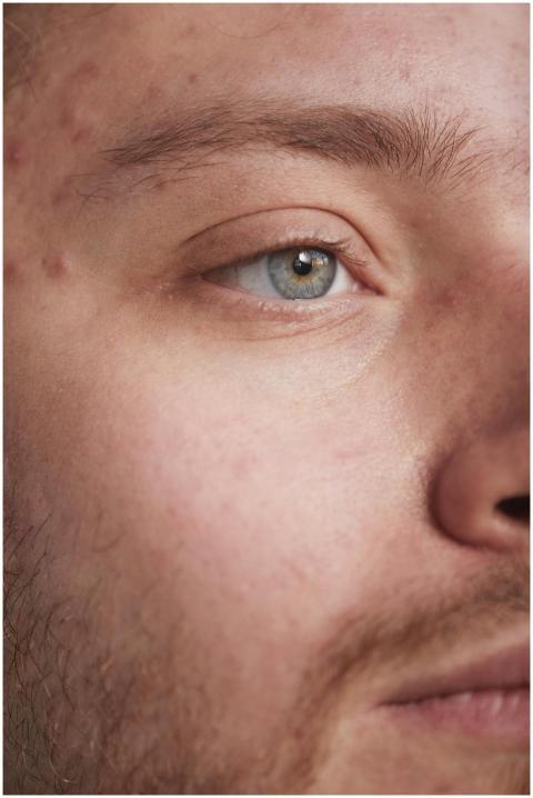 Extreme close-up of a man's face highlighting skin