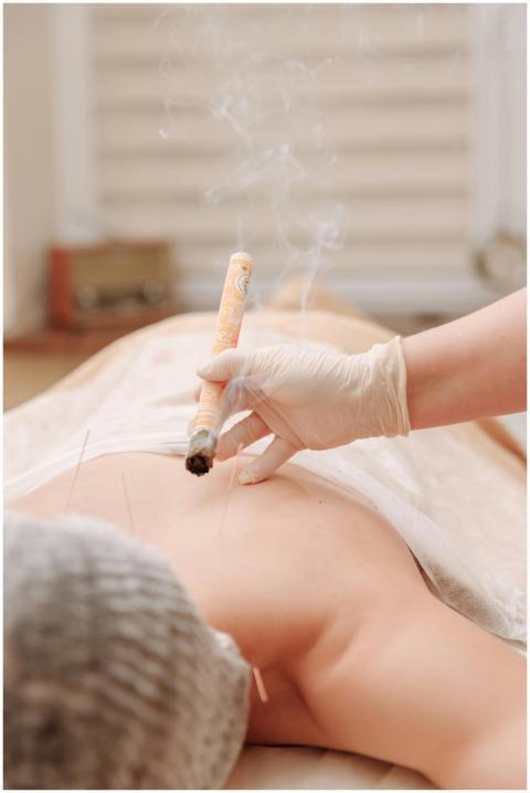 A moxibustion therapy session with acupuncture, sh