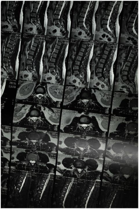 An in-depth medical imaging x-ray series focusing