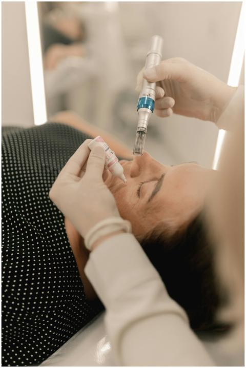 Close-up of person receiving microneedling beauty